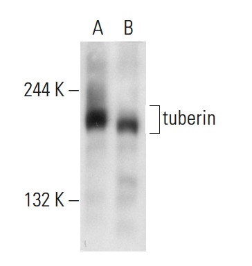  tuberin (B-5): sc-271314. Western blot analysis of tuberin expression in PC-3 (A) and Jurkat (B) whole cell lysates.