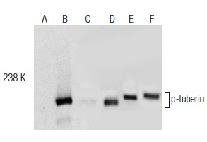  Western blot analysis of tuberin phosphorylation in untreated (A,D), PMA/Calyculin A treated (B,E) and PMA/Calyculin A and lambda protein phosphatase (sc-200312A) treated (C,F) Jurkat whole cell lysates. Antibodies tested include p-tuberin (325.Ser 1798): sc-293149 (A,B,C) and tuberin (B-5): sc-271314 (D,E,F).