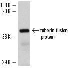  tuberin (H-300): sc-13012. Western blot analysis of human recombinant tuberin fusion protein.