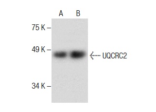  UQCRC2 (G-4): sc-390161. Western blot analysis of UQCRC2 expression in Jurkat whole cell lysate (A) and human skeletal muscle tissue extract (B).