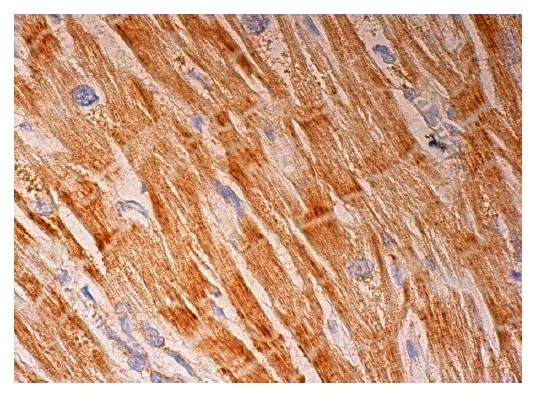  UQCRC2 (G-10): sc-390378. Immunoperoxidase staining of formalin fixed, paraffin-embedded human heart muscle tissue showing cytoplasmic staining of myocytes.