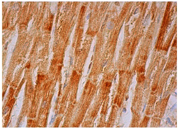  UQCRC2 (C-14): sc-69064. Immunoperoxidase staining of formalin fixed, paraffin-embedded human heart muscle tissue showing cytoplasmic staining of myocytes.