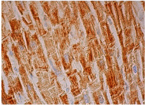  UQCRC2 (G-16): sc-69065. Immunoperoxidase staining of formalin fixed, paraffin-embedded human heart muscle tissue showing cytoplasmic staining of myocytes.