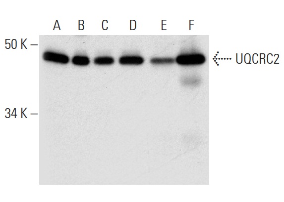  UQCRC2 (H-135): sc-292924. Western blot analysis of UQCRC2 expression in Jurkat (A), Ramos (B), A-431 (C) and WiDR (D) whole cell lysates and human colon (E) and human skeletal muscle (F) tissue extracts.