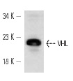  VHL (D-7): sc-55506. Western blot analysis of VHL expression in F9 whole cell lysate.