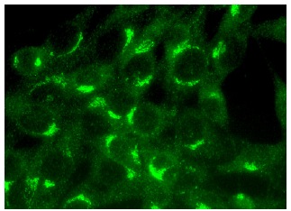  VHL (D-7): sc-55506. Immunofluorescence staining of methanol-fixed NIH/3T3 cells showing Golgi apparatus localization.