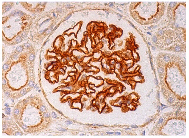  VHL (D-7): sc-55506. Immunoperoxidase staining of formalin fixed, paraffin-embedded human kidney tissue showing membrane and cytoplasmic staining of cells in glomeruli and apical membrane and cytoplasmic staining of cells in tubules. 