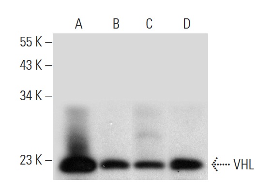  VHL (D-7): sc-55506. Western blot analysis of VHL expression in mouse testis (A), mouse brain (B) and mouse lung (C) tissue extracts and RAW 264.7 whole cell lysate (D).