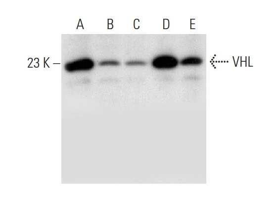  VHL (G-3): sc-514041. Western blot analysis of VHL expression in mouse testis (A), mouse brain (B) and mouse lung (C) tissue extracts and F9 (D) and RAW 264.7 (E) whole cell lysates.