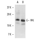  VHL (M-20): sc-1534. Western blot analysis of VHL expression in mouse brain (A) and mouse testis (B) tissue extracts.