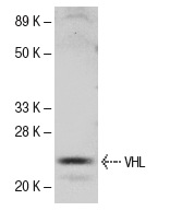  VHL (M-20): sc-1534. Western blot analysis of VHL in mouse brain tissue extract.