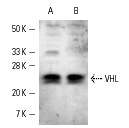  VHL (R-20): sc-1535. Western blot analysis of VHL expression in 3611-RF (A) and KNRK (B) nuclear extracts.