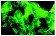  VHL (R-20): sc-1535. Immunofluorescence staining of methanol-fixed F9 cells showing membrane localization.