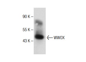  WWOX (D-9): sc-390175. Western blot analysis of WWOX expression in mouse ovary tissue extract.