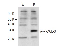  XAGE-3 (K-13): sc-169823. Western blot analysis of XAGE-3 expression in non-transfected: sc-117752 (A) and human XAGE-3 transfected: sc-370723 (B) 293T whole cell lysates.