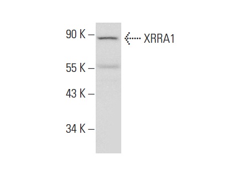  XRRA1 (N-14): sc-241743. Western blot analysis of XRRA1 expression in Hep G2 whole cell lysate.