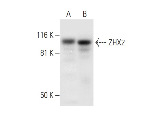  ZHX2 (D-2): sc-393399. Western blot analysis of ZHX2 expression in Caki-1 whole cell lysate (A) and Jurkat nuclear extract (B).