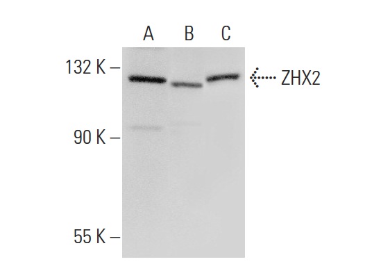  ZHX2 (P-20): sc-55443. Western blot analysis of ZHX2 expression in Hep G2 (A), HeLa (B) and ZR-75-1 (C) whole cell lysates.