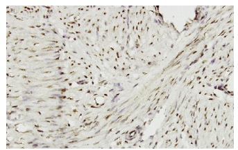  ZHX2 (Z-07): sc-101256. Immunoperoxidase staining of formalin-fixed, paraffin-embedded human smooth muscle tissue showing nuclear localization.