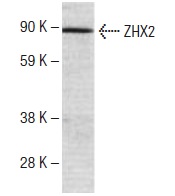  ZHX2 (U-21): sc-134166. Western blot analysis of ZHX2 expression in SP2/0 whole cell lysate.