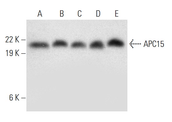  APC15 (H-9): sc-398488. Western blot analysis of APC15 expression in T98G (A), HUV-EC-C (B), Caki-1 (C), HT-1080 (D) and HeLa (E) whole cell lysates.