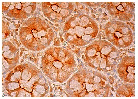  APC2 (M-20) : sc-9931. Immunoperoxidase staining of formalin fixed, paraffin-embedded human colon tissue showing cytoplasmic and membrane staining of glandular cells. 