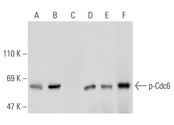  Western blot analysis of Cdc6 phosphorylation in untreated (A,D), serum starved and treated (B,E) and serum starved, serum treated and lambda protein phosphatase (sc-200312A) treated (C,F) HeLa whole cell lysates. Antibodies tested include p-Cdc6 (Ser 54)-R: sc-12920-R (A,B,C) and Cdc6 (D-1): sc-13136 (D,E,F).