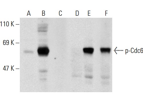  Western blot analysis of Cdc6 phosphorylation in untreated (A,D), serum starved and serum treated (B,E) and serum starved, serum treated and lambda protein phosphatase (sc-200312A) treated (C,F) HeLa whole cell lysates. Antibodies tested include p-Cdc6 (Ser 54)-R: sc-12920-R (A,B,C) and Cdc6 (D-1): sc-13136 (D,E,F).