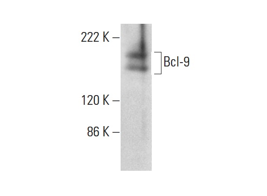  Bcl-9 (B-4): sc-398131. Western blot analysis of Bcl-9 expression in HeLa nuclear extract.