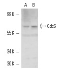  Cdc6 (H-304): sc-8341. Western blot analysis of Cdc6 expression in HeLa whole cell lysate (A) and HeLa nuclear extract (B).