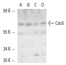  Cdc6 (H-304): sc-8341. Western blot analysis of Cdc6 expression in HeLa (A) and NIH/3T3 (B) whole cell lysates and Jurkat (C) and HeLa (D) nuclear extracts.