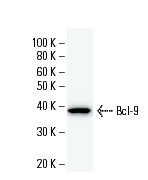  Bcl-9 (2071C3a): sc-81199 Western Blot analysis of human recombinant Bcl-9 fusion protein.