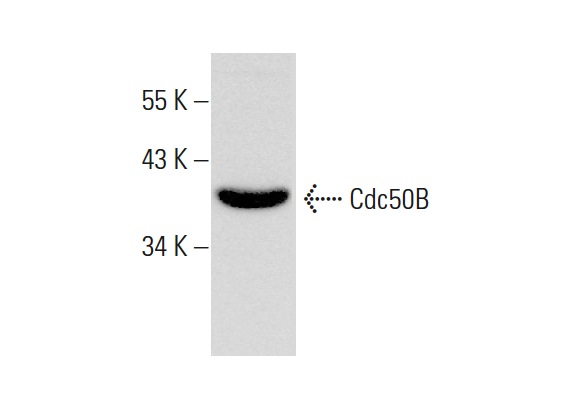  Cdc50B (Y-12): sc-164015. Western blot analysis of Cdc50B expression in human liver tissue extract.