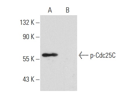  p-Cdc25C (Ser 216)-R: sc-12354-R. Western blot analysis of Cdc25C phosphorylation in untreated (A) and lambda protein phosphatase treated (B) K-562 whole cell lysates.