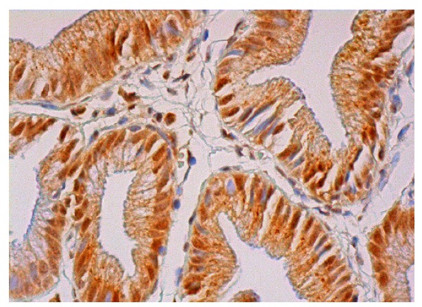  p-Cdc6 (Ser 106)-R: sc-12922-R. Immunoperoxidase staining of formalin fixed, paraffin-embedded human gall bladder tissue showing nuclear and cytoplasmic staining of glandular cells.