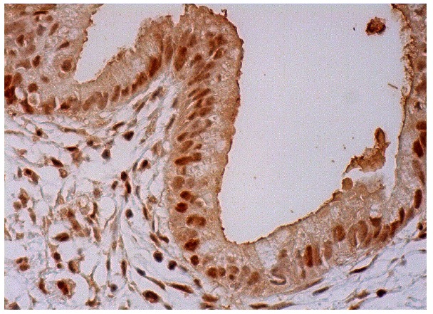  p-Cdc6 (Ser 54): sc-12920. Immunoperoxidase staining of formalin fixed, paraffin-embedded human gall bladder tissue showing nuclear and cytoplasmic staining of glandular cells.