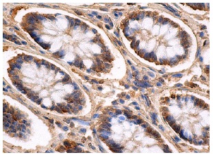  Cdk1/Cdk2 (AN21.2): sc-53219. Immunoperoxidase staining of formalin fixed, paraffin-embedded human colon tissue showing cytoplasmic and nuclear staining of glandular cells.