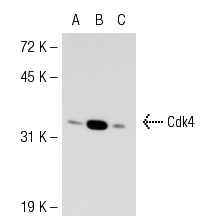  Cdk4 (DCS-35): sc-23896. Western blot analysis of Cdk4 expression in non-transfected 293T: sc-117752 (A), mouse Cdk4 transfected 293T: sc-119150 (B) and HeLa (C) whole cell lysates.