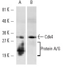  Immunoprecipitation of Cdk4 from HeLa whole cell lysate using Cdk4 (DCS-35): sc-23896 (mouse monoclonal antibody) followed by Western blot analysis using Cdk4 (C-22)-G: sc-260-G (goat polyclonal antibody). Note presence of Protein A/G band using Protein A/G PLUS-Agarose: sc-2003 conventional IP matrix (A) as compared to their absence using ExactaCruz A: sc-45038 (B).