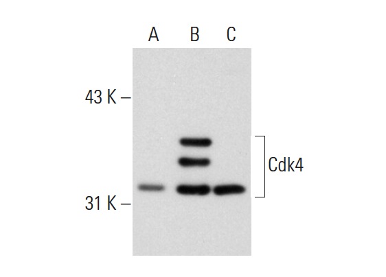  Cdk4 (DCS-35): sc-23896. Western blot analysis of Cdk4 expression in non-transfected 293: sc-110760 (A), human Cdk4 transfected 293: sc-158369 (B) and HeLa (C) whole cell lysates.