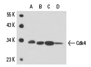  Cdk4 (SPM382): sc-56361. Western blot analysis of Cdk4 expression in HeLa whole cell lysate.