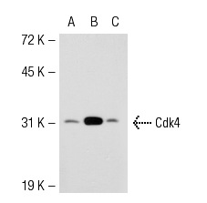  Cdk4 (SPM382): sc-56361. Western blot analysis of Cdk4 expression in non-transfected 293T: sc-117752 (A), mouse Cdk4 transfected 293T: sc-119150 (B) and HeLa (C) whole cell lysates.