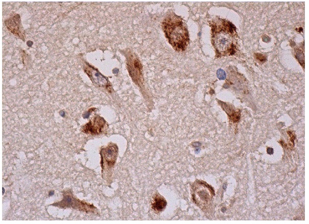  Cdk11 (D-20): sc-69245. Immunoperoxidase staining of formalin fixed, paraffin-embedded human cerebral cortex tissue showing cytoplasmic and weak nuclear staining of neuronal cells and cytoplasmic staining of glial cells.