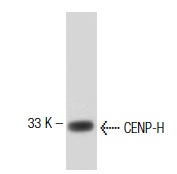  CENP-H (5): sc-136403. Western blot analysis of CENP-H expression in P19 whole cell lysate.