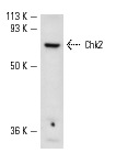  Chk2 (S-19): sc-8814. Western blot analysis of Chk2 expression in WEHI-231 whole cell lysate.