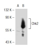  Chk2 (S-19): sc-8814. Western blot analysis of Chk2 expression in non-transfected: sc-117752 (A) and mouse Chk2 transfected: sc-119229 (B) 293T whole cell lysates.