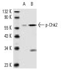  p-Chk2 (Thr 68)-R: sc-16297-R. Western blot analysis of Chk2 phosphorylation in HL-60 (A) and PMA-treated HL-60 (B) whole cell lysates.