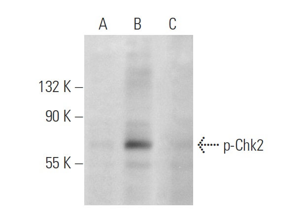  p-Chk2 (Thr 68)-R: sc-16297-R. Western blot analysis of Cdc2 p34 phosphorylation in untreated (A), UV irradiated (B) and UV irradiated and lambda protein phosphatase treated (C) HeLa whole cell lysates.