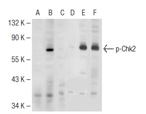  Western blot analysis of Chk2 phosphorylation in untreated (A,D), UV irradiated (B,E) and UV irradiated and lambda protein phosphatase treated (C,F) HeLa whole cell lysates. Antibodies tested include p-Chk2 (Thr 68)-R: sc-16297-R (A,B,C) and Chk2 (C-18): sc-8813 (D,E,F).