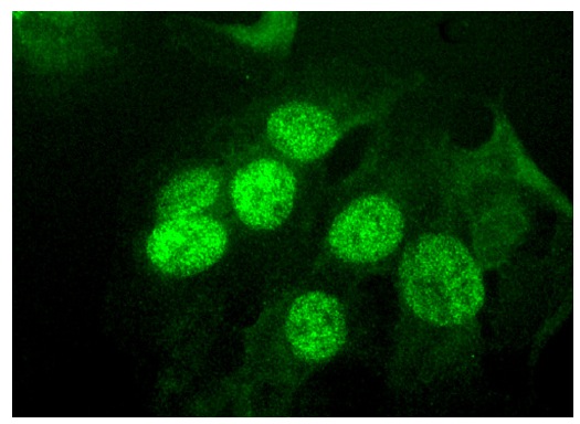  Claspin (B-6): sc-376773. Immunofluorescence staining of formalin-fixed HepG2 cells showing nuclear and cytoplasmic localization.